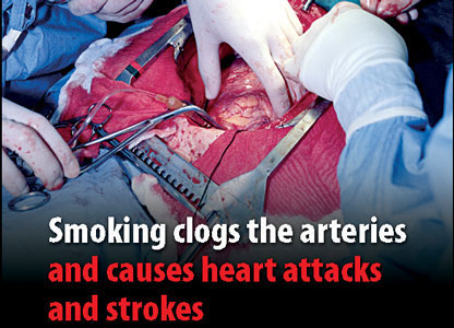 smoking_operation.jpg