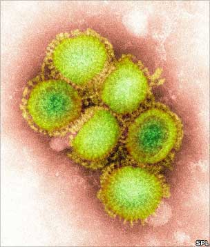 H1N1