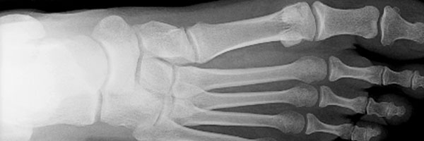 The 'foot' bone