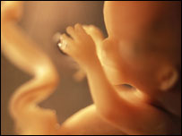 Feto (foto: Dopamine/Science Photo Library)