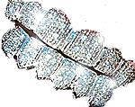 Bling Teeth