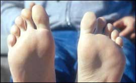 Toes