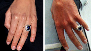 A ring