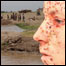 مردار دانه 