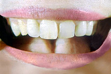 A mouth