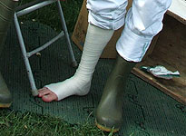 Mika and his foot